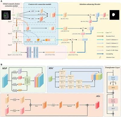 GL-Segnet: Global-Local representation learning net for medical image segmentation
